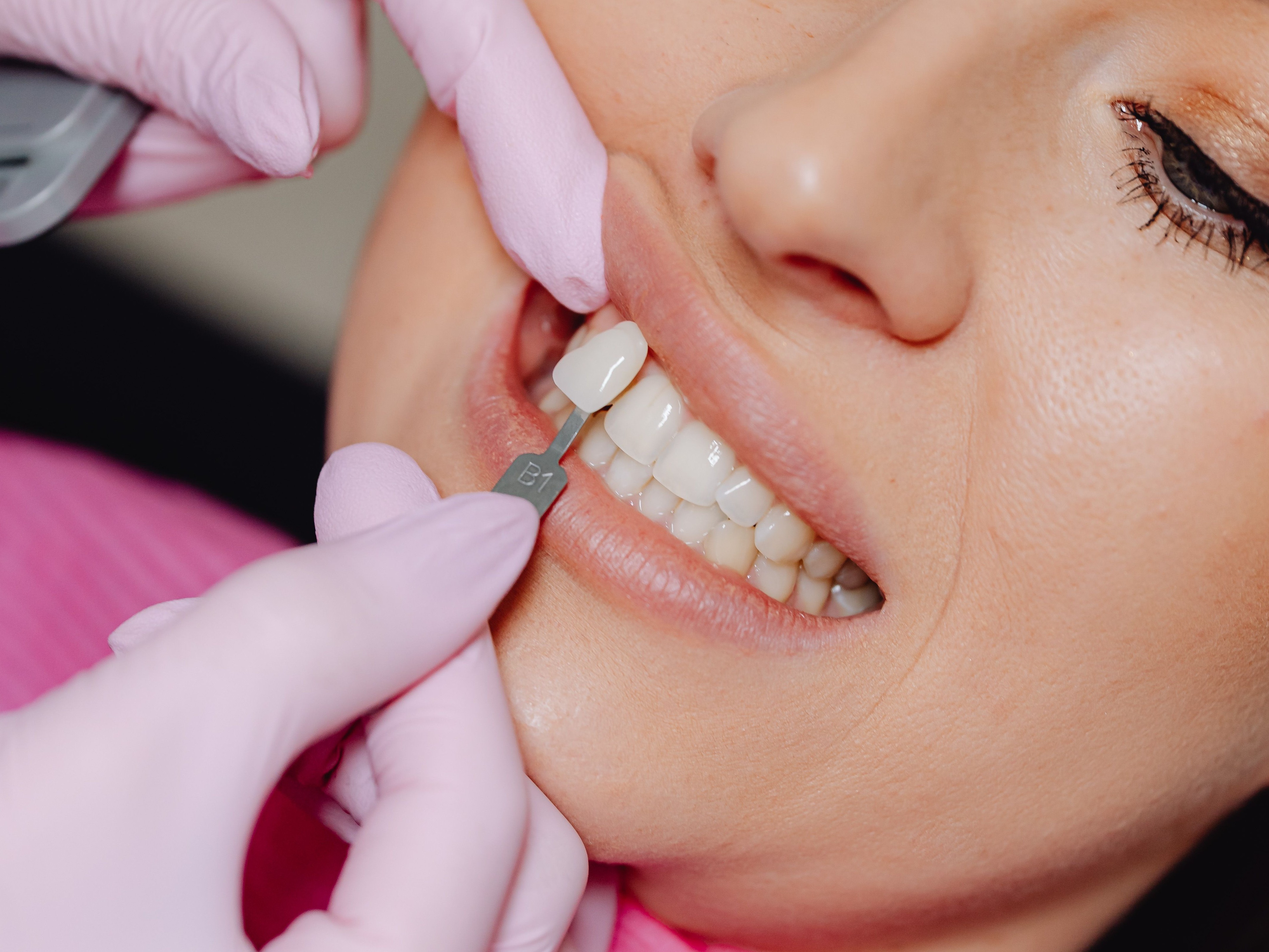 ESTETICA DENTALE 